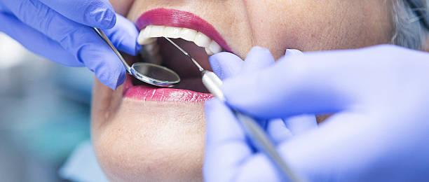 Best Emergency Tooth Extraction in Osceola, IN